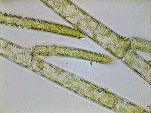 14-cladophora2.jpg